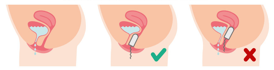 tampon contam