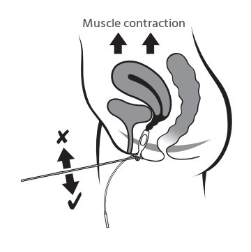 vaginal probe