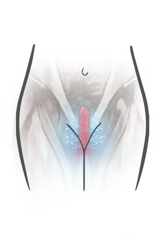 magnetic dilators
